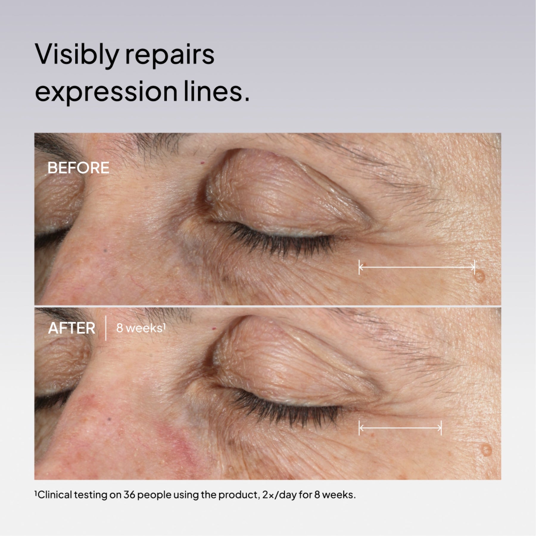 NIOD Fractionated Eye Contour Concentrate before and after