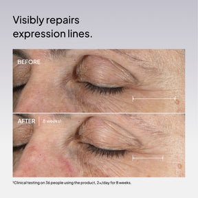 NIOD Fractionated Eye Contour Concentrate before and after